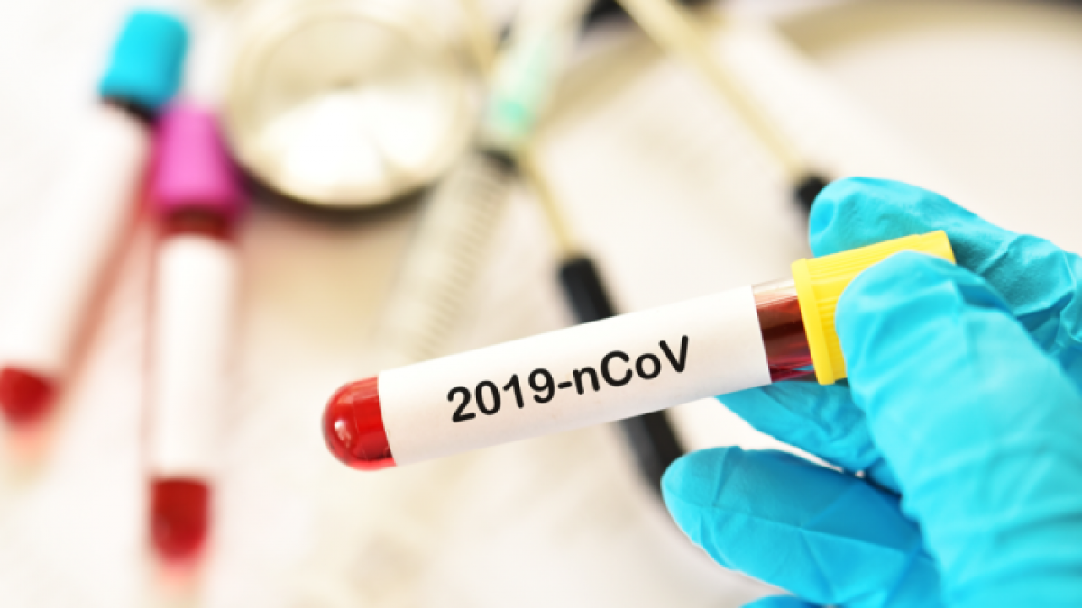 Alcaldía confirma los dos primeros casos de contagio por Covid-19